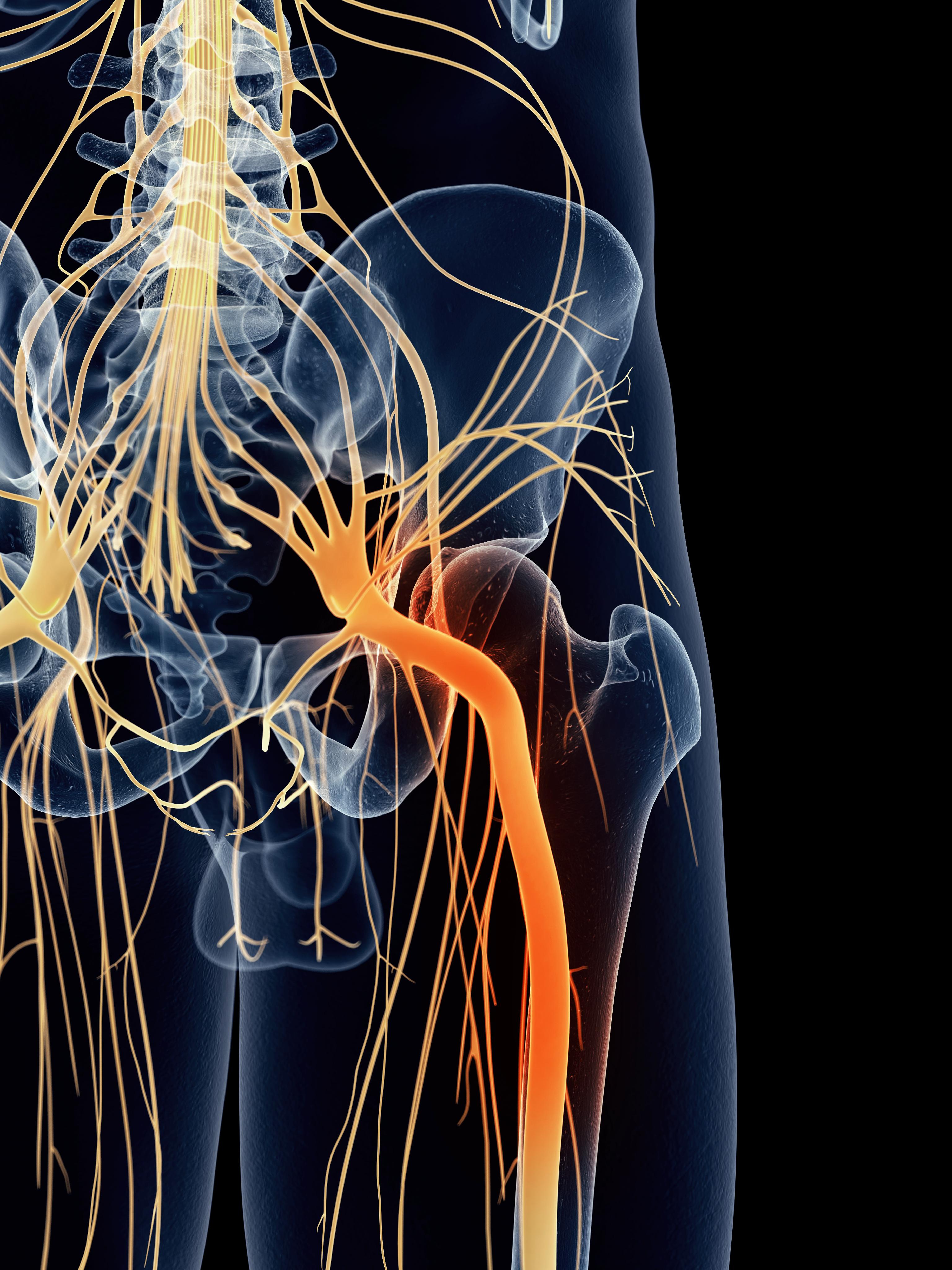 Neuropathy nerve treatment